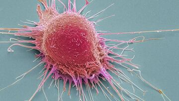 Nuevo enfoque en la lucha contra el cáncer: el doble efecto de una terapia