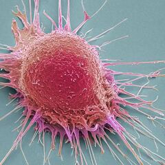 Nuevo enfoque en la lucha contra el cáncer: el doble efecto de una terapia