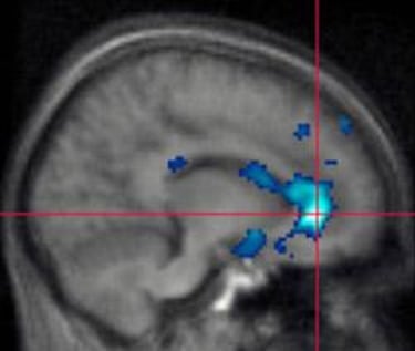 Los juegos violentos activan en el cerebro la "zona agresiva"