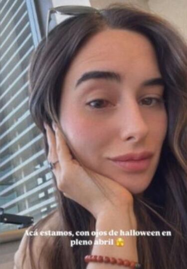 Melina Noto da a conocer inesperada complicación durante el embarazo y toma una decisión: “Por el bien de mi guagüita...”