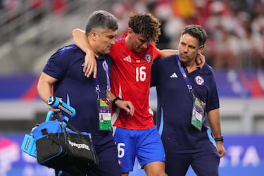 La preocupación de Gareca: así está el panorama de los dos lesionados en la Roja