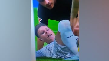 La escalofriante reacción de Ter Stegen al ver por primera vez su rodilla: el grito es desolador