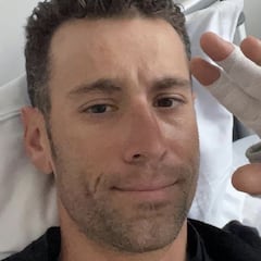 Nibali, tras su operación: "El objetivo es estar en el Giro"