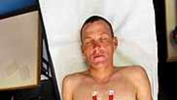 <B>EL CORAZÓN DEL GUERRERO.</b> Armstrong, durante el electrocardiagrama que le hicieron ayer.