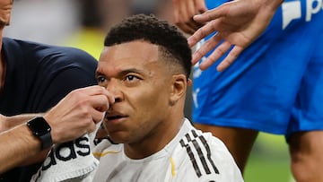 MADRID, 10/04/2026.- El delantero del Real Madrid Kylian Mbappé es atendido, durante el partido de la jornada 31 de LaLiga EA Sports que disputan Real Madrid y Girona FC este viernes, en el estadio Santiago Bernabéu. EFE/Sergio Pérez