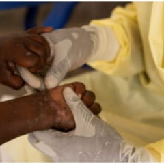 Una nueva enfermedad mortal desconocida mata a más de 50 personas en horas y los médicos lanzan un aviso