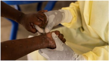 Una nueva enfermedad mortal desconocida mata a más de 50 personas en horas y los médicos lanzan un aviso