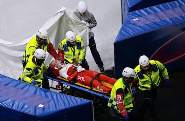 Los exámenes confirman fractura facial y Kamila pasa por quirófano para recomponer el pómulo. El parte habla de primeras pruebas positivas y seguimiento de la movilidad ocular. Queda fuera de la prueba y su evolución marcará los plazos.