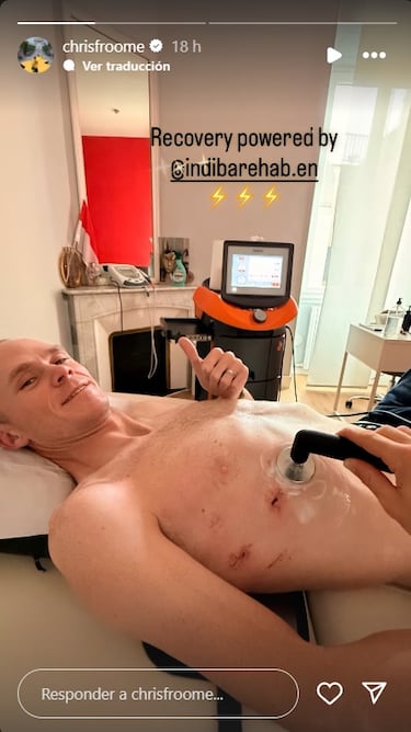 Froome enseña las heridas tras su grave accidente entrenando