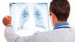 ¿Cómo funciona la app argentina para detectar casos de coronavirus en una radiografía?