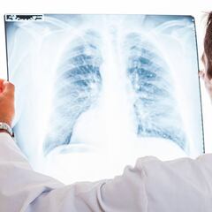 ¿Cómo funciona la app argentina para detectar casos de coronavirus en una radiografía?