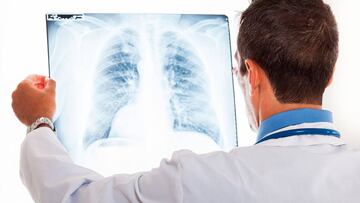 ¿Cómo funciona la app argentina para detectar casos de coronavirus en una radiografía?