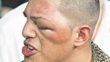 <b>UN POEMA. </b>Así quedó el rostro de Fernando Vargas tras el combate.