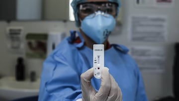 NITEROI, BRAZIL - APRIL 17: A health care worker holds a test for patients suspected of being infected with for the coronavirus (COVID-19) at the Center Health Teixeira de Freitas, on April 17, 2020 in Niteroi, Brazil. The municipality's health depar