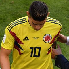 Parte médico de James: Edema en el sóleo derecho