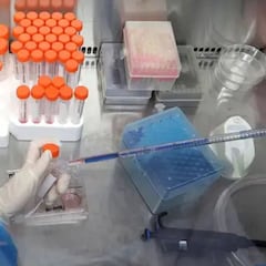 Identificados los factores que provocan riesgo grave por COVID