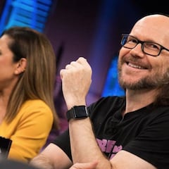 Santiago Segura, sobre su calvicie: "Estoy traumatizado. Fui a Turquía"