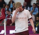 De Bruyne no levanta cabeza: “Fuera unos 4 meses”