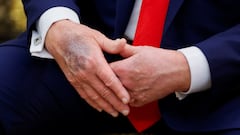 ‘Is Trump dead?’ trending on social media: here’s why the rumour is lighting up the internet