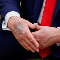 ‘Is Trump dead?’ trending on social media: here’s why the rumour is lighting up the internet