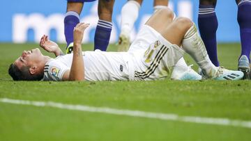 El globo de James se pincha