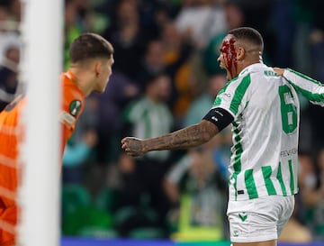 El defensa del Betis, se golpea con Zec en el momento de anotar el gol 1-0 para el Betis. Su rostro ensangrentado no le impide celebrar el gol.