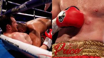 Imagen del momento del mordisco de Kash Ali a David Price y de la marca de la modedura en el abdomen de Price.