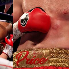 Suspenden la licencia de Kash Ali, el boxeador que mordió a otro en pleno combate