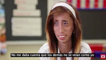 Lizzie Velasquez (YouTube)