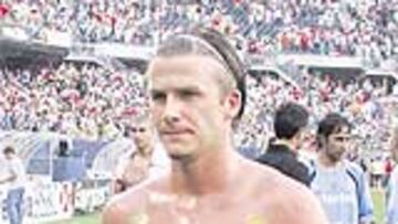 <b>DAVID LOS USA</b>. Beckham lleva habitualmente parches para quemar grasas.