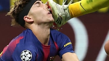 Fermín suffers bloody fate in nasty Champions League clash