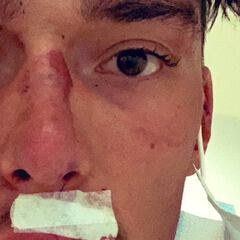 Dura caída de Simon Pellaud tras fallarle los frenos de disco