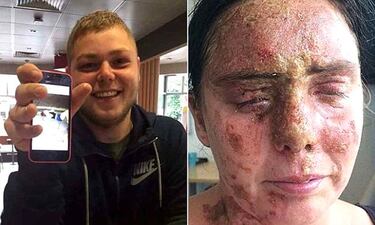 Presume en Facebook de quemar con ácido la cara de una mujer
