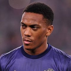 Anthony Martial, el “fichaje bomba” con letra chica: un historial médico que enciende alarmas en la Liga MX