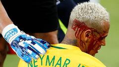 Así terminó Neymar tras el duro codazo del boliviano Duk
