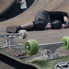 Tony Hawk se rompe el fémur con 53 años: "Volveré a patinar"