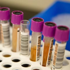 Científicos hallan por qué se forman coágulos de sangre con la COVID-19