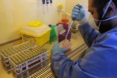 Coronavirus in UK: how to volunteer for the clinical trials