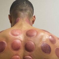 Danjuma se suma al 'metodo Benzema'... ¡Así quedó su espalda!