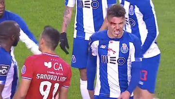 El brutal golpe que recibe Matheus Uribe en la cabeza