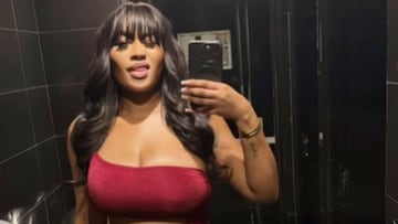 Muere la influencer y modelo Ngoye Ndiaye tras someterse a una operación de glúteos