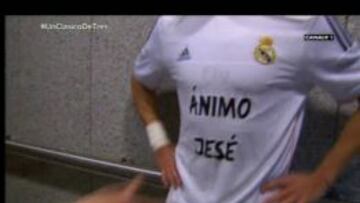 El Madrid y el Castilla mandan fuerzas al lesionado Jesé