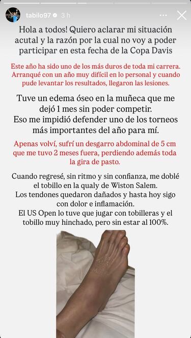 Tabilo explica su ausencia en la Copa Davis y le deja un mensaje a Chile: “Nadie sabe...”