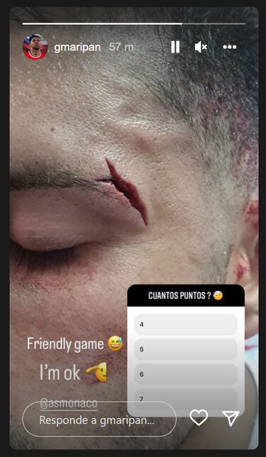 La imagen de Maripán que impacta a las redes