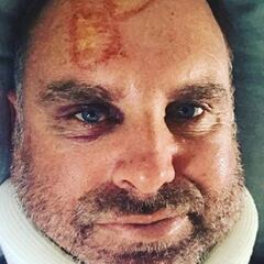 Oz cricketer Matthew Hayden fractures neck in surfing accident