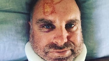 Oz Cricketer Matthew Hayden fractures neck in surfing accident