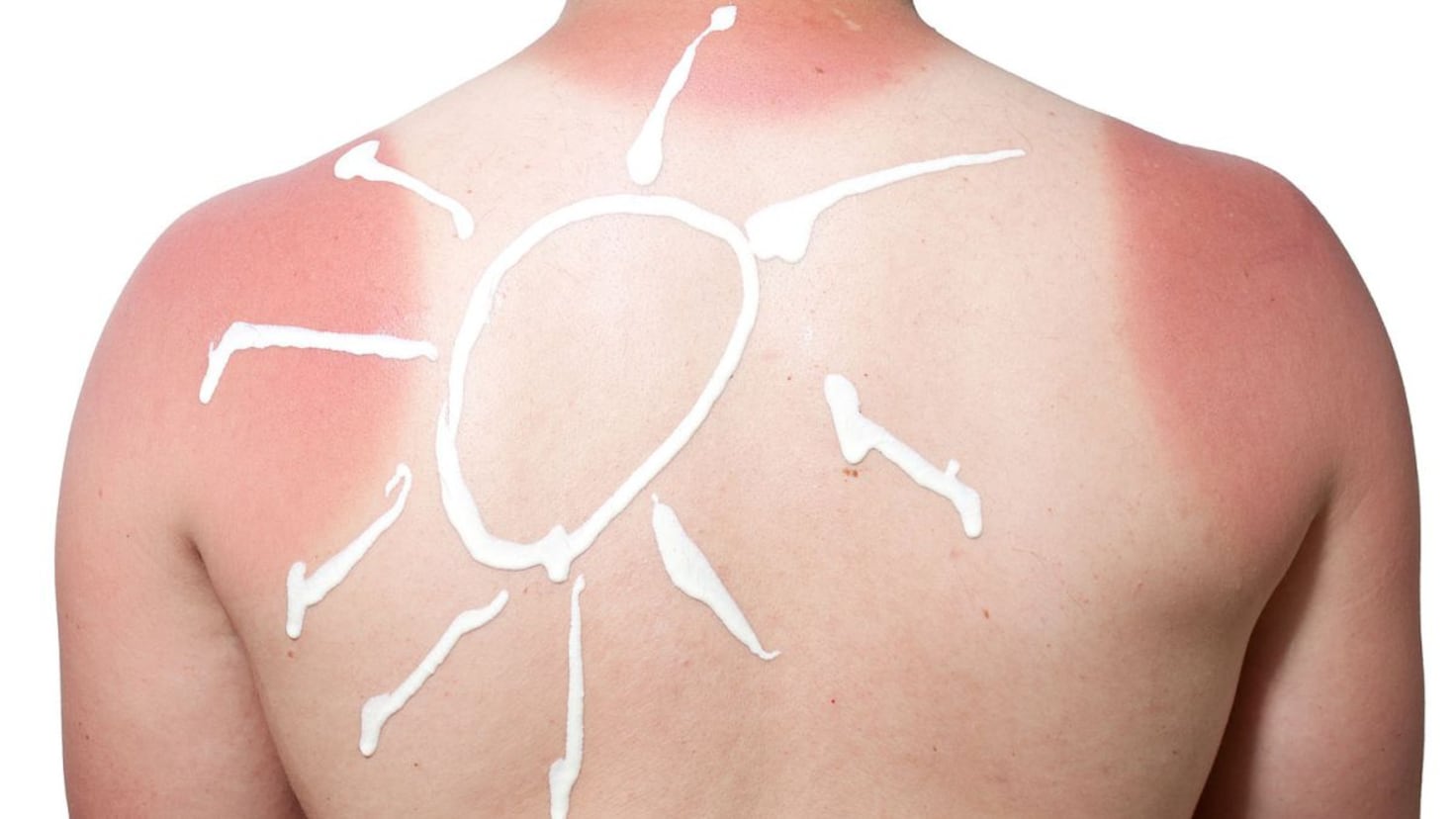 ¡Peligro en la Playa! El Hábito Común que Daña tu Piel (y que no Sabías)