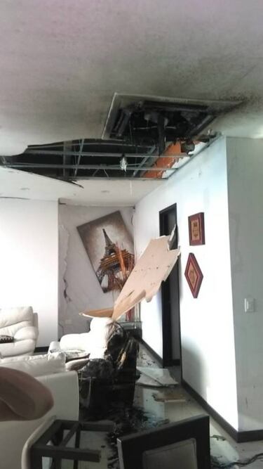 Pedro Gallese sufrió explosión en su hogar