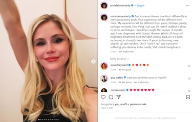 La actriz Erin Moriarty, de ‘The Boys’, revela que sufre la enfermedad de Graves: “No debí achacarlo al estrés”