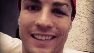 Esta es la fotografía que Cristiano Ronaldo ha subido en su 'Facebook' para tranquilizar a sus seguidores sobre su estado de salud.